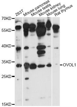 OVOL1 Antibody - Western blot analysis of extracts of various cell lines, using OVOL1 antibody at 1:1000 dilution. The secondary antibody used was an HRP Goat Anti-Rabbit IgG (H+L) at 1:10000 dilution. Lysates were loaded 25ug per lane and 3% nonfat dry milk in TBST was used for blocking. An ECL Kit was used for detection and the exposure time was 30s.