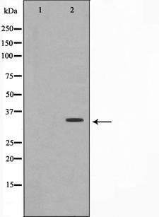 OVOL1 Antibody - Western blot analysis on A549 cell lysates using OVOL1 antibody. The lane on the left is treated with the antigen-specific peptide.
