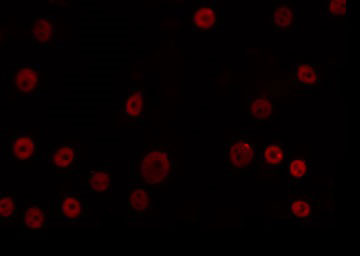 OVOL1 Antibody - Staining K562 cells by IF/ICC. The samples were fixed with PFA and permeabilized in 0.1% Triton X-100, then blocked in 10% serum for 45 min at 25°C. The primary antibody was diluted at 1:200 and incubated with the sample for 1 hour at 37°C. An Alexa Fluor 594 conjugated goat anti-rabbit IgG (H+L) Ab, diluted at 1/600, was used as the secondary antibody.