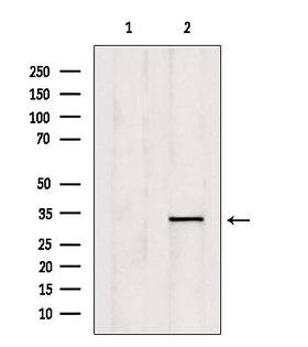 OVOL1 Antibody - Western blot analysis of extracts of mouse brain tissue using OVOL1 antibody. Lane 1 was treated with the blocking peptide.