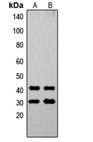 OVOL1 Antibody - Western blot analysis of OVOL1 expression in A549 (A); Jurkat (B) whole cell lysates.