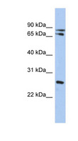 OVOL2 Antibody - OVOL2 antibody Western blot of HT1080 cell lysate. This image was taken for the unconjugated form of this product. Other forms have not been tested.