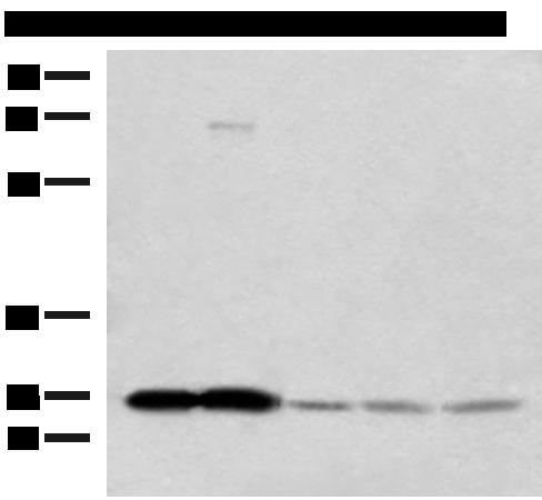OVOL2 Antibody - Western blot analysis of Human cerebella tissue Human cerebrum tissue Human skin tissue NIH/3T3 cell SKOV3 cell lysates  using OVOL2 Polyclonal Antibody at dilution of 1:350