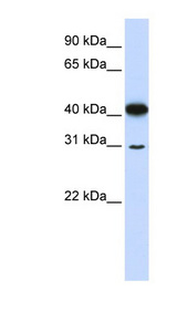 OVOL2 Antibody - OVOL2 antibody Western blot of 721_B cell lysate. This image was taken for the unconjugated form of this product. Other forms have not been tested.