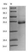 Ovomucoid / Gal d 1 Protein - (Tris-Glycine gel) Discontinuous SDS-PAGE (reduced) with 5% enrichment gel and 15% separation gel.