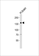 OVOS / Ovostatin Antibody - Western blot of lysate from human brain tissue lysate with OVOS1 Antibody. Antibody was diluted at 1:1000. A goat anti-rabbit IgG H&L (HRP) at 1:5000 dilution was used as the secondary antibody. Lysate at 35 ug.