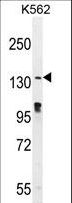 OVOS2 Antibody - OVOS Antibody western blot of K562 cell line lysates (35 ug/lane). The OVOS antibody detected the OVOS protein (arrow).