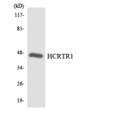 OX1R / Orexin Receptor 1 Antibody - Western blot analysis of the lysates from HepG2 cells using HCRTR1 antibody.