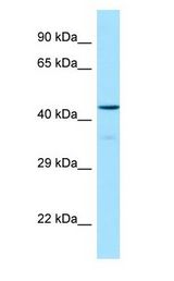 OX1R / Orexin Receptor 1 Antibody - OX1R / Orexin Receptor 1 antibody Western Blot of Human brain.  This image was taken for the unconjugated form of this product. Other forms have not been tested.