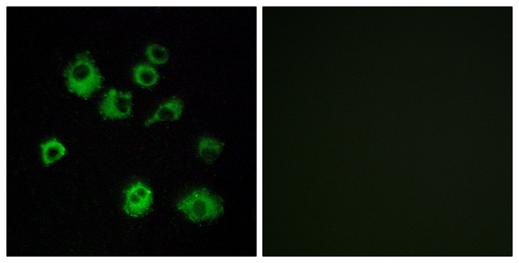 OX1R / Orexin Receptor 1 Antibody - Immunofluorescence analysis of MCF7 cells, using HCRTR1 Antibody. The picture on the right is blocked with the synthesized peptide.