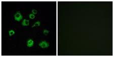 OX1R / Orexin Receptor 1 Antibody - Immunofluorescence analysis of MCF7 cells, using HCRTR1 Antibody. The picture on the right is blocked with the synthesized peptide.