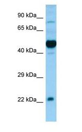 OX1R / Orexin Receptor 1 Antibody - OX1R / Orexin Receptor 1 antibody Western Blot of Fetal Brain.  This image was taken for the unconjugated form of this product. Other forms have not been tested.