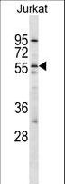 OX2R / Orexin Receptor 2 Antibody - HCRTR2 Antibody western blot of Jurkat cell line lysates (35 ug/lane). The HCRTR2 antibody detected the HCRTR2 protein (arrow).