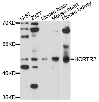 OX2R / Orexin Receptor 2 Antibody - Western blot analysis of extracts of mouse heart cells.
