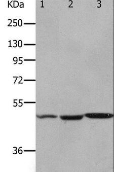 OX2R / Orexin Receptor 2 Antibody - Western blot analysis of Mouse kidney, brain and heart tissue, using HCRTR2 Polyclonal Antibody at dilution of 1:1100.