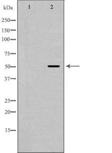 OX2R / Orexin Receptor 2 Antibody - Western blot analysis of extracts of mouse heart tissue using HCRTR2 antibody. The lane on the left is treated with the antigen-specific peptide.