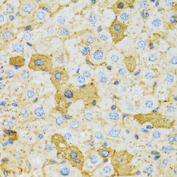 OXA1L / OXA1 Antibody - Immunohistochemistry of paraffin-embedded rat liver tissue.