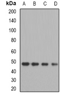 OXA1L / OXA1 Antibody - Western blot analysis of OXA1L expression in MCF7 (A); A549 (B); mouse kidney (C); mouse liver (D) whole cell lysates.
