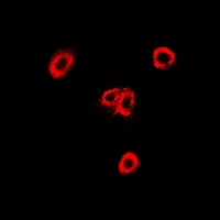 OXA1L / OXA1 Antibody - Immunofluorescent analysis of OXA1L staining in U2OS cells. Formalin-fixed cells were permeabilized with 0.1% Triton X-100 in TBS for 5-10 minutes and blocked with 3% BSA-PBS for 30 minutes at room temperature. Cells were probed with the primary antibody in 3% BSA-PBS and incubated overnight at 4 deg C in a humidified chamber. Cells were washed with PBST and incubated with a DyLight 594-conjugated secondary antibody (red) in PBS at room temperature in the dark.