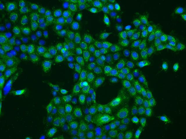 OXA1L / OXA1 Antibody - Immunofluorescence staining of OXA1L in A431 cells. Cells were fixed with 4% PFA, permeabilzed with 0.1% Triton X-100 in PBS, blocked with 10% serum, and incubated with rabbit anti-Human OXA1L polyclonal antibody (dilution ratio 1:200) at 4°C overnight. Then cells were stained with the Alexa Fluor 488-conjugated Goat Anti-rabbit IgG secondary antibody (green) and counterstained with DAPI (blue). Positive staining was localized to Cytoplasm.