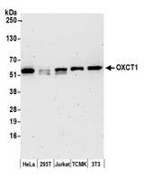 OXCT1 Antibody - Detection of human and mouse OXCT1 by western blot. Samples: Whole cell lysate (15 µg) from HeLa, HEK293T, Jurkat, mouse TCMK-1, and mouse NIH 3T3 cells prepared using NETN lysis buffer. Antibody: Affinity purified rabbit anti-OXCT1 antibody used for WB at 0.04 µg/ml. Detection: Chemiluminescence with an exposure time of 3 minutes.