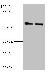OXCT1 Antibody - Western blot All lanes: OXCT1 antibody at 8µg/ml Lane 1: Mouse heart tissue Lane 2: Mouse kidney tissue Secondary Goat polyclonal to rabbit IgG at 1/10000 dilution Predicted band size: 57, 14 kDa Observed band size: 57 kDa