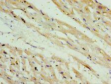 OXCT1 Antibody - Immunohistochemistry of paraffin-embedded human heart tissue using antibody at 1:100 dilution.