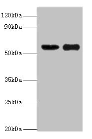 OXCT1 Antibody - Western blot All lanes: OXCT1 antibody at 8µg/ml Lane 1: Mouse heart tissue Lane 2: Mouse kidney tissue Secondary Goat polyclonal to rabbit IgG at 1/10000 dilution Predicted band size: 57, 14 kDa Observed band size: 57 kDa