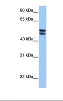 OXCT1 Antibody - HepG2 cell lysate. Antibody concentration: 1.0 ug/ml. Gel concentration: 12%.  This image was taken for the unconjugated form of this product. Other forms have not been tested.