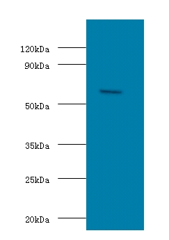 OXCT1 Antibody - Western blot of Succinyl-CoA:3-ketoacid coenzyme A transferase 1, mitochondrial antibody at 2 ug/ml with HeLa whole cell lysate. Secondary: Goat polyclonal to Rabbit IgG at 1:15000 dilution. Predicted band size: 56 KDa. Observed band size: 56 KDa.  This image was taken for the unconjugated form of this product. Other forms have not been tested.