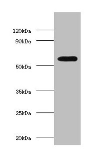 OXCT1 Antibody - Western blot All lanes: Succinyl-CoA: 3-ketoacid coenzyme A transferase 1, mitochondrial antibody at 2µg/ml + Hela whole cell lysate Secondary Goat polyclonal to rabbit IgG at 1/15000 dilution Predicted band size: 57, 14 kDa Observed band size: 57 kDa