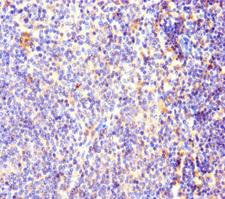 OXCT1 Antibody - Immunohistochemistry of paraffin-embedded human lymphoid tissue using OXCT1 Antibody at dilution of 1:100
