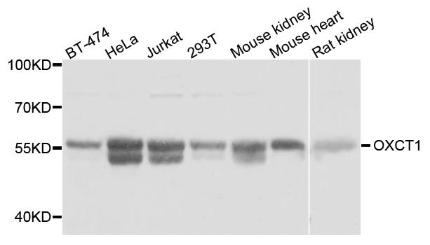 OXCT1 Antibody - Western blot analysis of extracts of various cell lines.