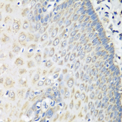 OXCT1 Antibody - Immunohistochemistry of paraffin-embedded human esophagus.
