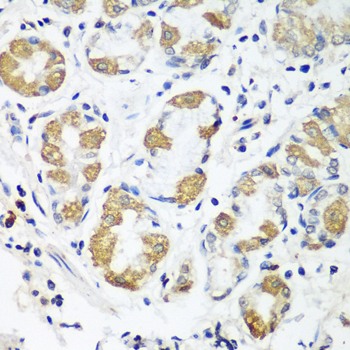 OXCT1 Antibody - Immunohistochemistry of paraffin-embedded human stomach tissue.