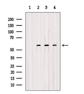 OXCT1 Antibody - Western blot analysis of extracts of various samples using OXCT1 antibody. Lane 1: rat brain treated with blocking peptide. Lane 2: rat brain; Lane 3: 293; Lane 4: mouse spleen; Lane 5: HeLa;