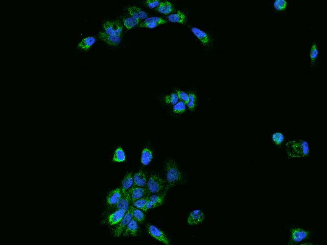 OXCT1 Antibody - Immunofluorescence staining of OXCT1 in A431 cells. Cells were fixed with 4% PFA, permeabilzed with 0.1% Triton X-100 in PBS, blocked with 10% serum, and incubated with rabbit anti-Human OXCT1 polyclonal antibody (dilution ratio 1:200) at 4°C overnight. Then cells were stained with the Alexa Fluor 488-conjugated Goat Anti-rabbit IgG secondary antibody (green) and counterstained with DAPI (blue). Positive staining was localized to Cytoplasm.