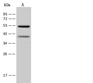 OXCT1 Antibody - Anti-OXCT1 rabbit polyclonal antibody at 1:500 dilution. Lane A: U-251 MG Whole Cell Lysate. Lysates/proteins at 30 ug per lane. Secondary: Goat Anti-Rabbit IgG (H+L)/HRP at 1/10000 dilution. Developed using the ECL technique. Performed under reducing conditions. Predicted band size: 56 kDa. Observed band size: 55 kDa.