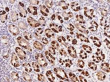 OXCT1 Antibody - Immunochemical staining of human OXCT1 in human stomach with rabbit polyclonal antibody at 1:500 dilution, formalin-fixed paraffin embedded sections.