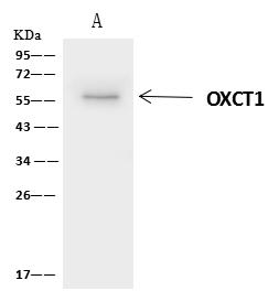 OXCT1 Antibody - OXCT1 was immunoprecipitated using: Lane A: 0.5 mg U251MG Whole Cell Lysate. 4 uL anti-OXCT1 rabbit polyclonal antibody and 60 ug of Immunomagnetic beads Protein A/G. Primary antibody: Anti-OXCT1 rabbit polyclonal antibody, at 1:100 dilution. Secondary antibody: Clean-Blot IP Detection Reagent (HRP) at 1:1000 dilution. Developed using the ECL technique. Performed under reducing conditions. Predicted band size: 56 kDa. Observed band size: 56 kDa.