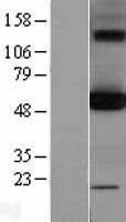 OXCT1 Protein - Western validation with an anti-DDK antibody * L: Control HEK293 lysate R: Over-expression lysate