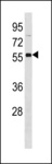 OXCT2 Antibody - OXCT2 Antibody western blot of Jurkat cell line lysates (35 ug/lane). The OXCT2 antibody detected the OXCT2 protein (arrow).