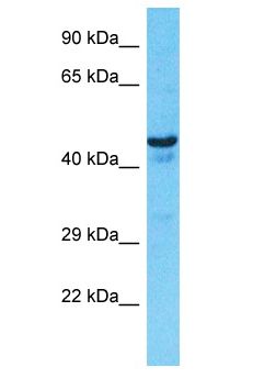 OXER1 Antibody - OXER1 antibody Western Blot of 786-0. Antibody dilution: 1 ug/ml.  This image was taken for the unconjugated form of this product. Other forms have not been tested.