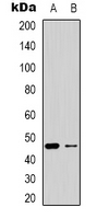 OXER1 Antibody - Western blot analysis of GPR170 expression in Jurkat (A); NIH3T3 (B) whole cell lysates.