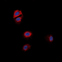 OXER1 Antibody - Immunofluorescent analysis of GPR170 staining in MCF7 cells. Formalin-fixed cells were permeabilized with 0.1% Triton X-100 in TBS for 5-10 minutes and blocked with 3% BSA-PBS for 30 minutes at room temperature. Cells were probed with the primary antibody in 3% BSA-PBS and incubated overnight at 4 deg C in a humidified chamber. Cells were washed with PBST and incubated with a DyLight 594-conjugated secondary antibody (red) in PBS at room temperature in the dark. DAPI was used to stain the cell nuclei (blue).