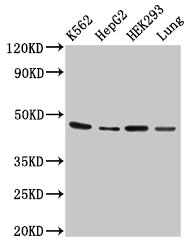 OXER1 Antibody - Positive Western Blot detected in K562 whole cell lysate, HepG2 whole cell lysate, HEK293 whole cell lysate, Rat lung tissue. All lanes: OXER1 antibody at 2 µg/ml Secondary Goat polyclonal to rabbit IgG at 1/50000 dilution. Predicted band size: 46 KDa. Observed band size: 46 KDa