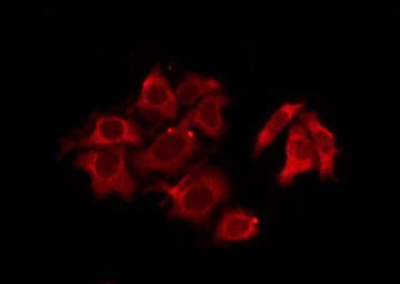 OXER1 Antibody - Staining MCF-7 cells by IF/ICC. The samples were fixed with PFA and permeabilized in 0.1% Triton X-100, then blocked in 10% serum for 45 min at 25°C. The primary antibody was diluted at 1:200 and incubated with the sample for 1 hour at 37°C. An Alexa Fluor 594 conjugated goat anti-rabbit IgG (H+L) Ab, diluted at 1/600, was used as the secondary antibody.