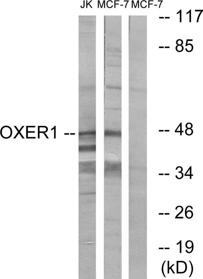 OXER1 Antibody - Western blot analysis of extracts from Jurkat cells and MCF-7 cells, using OXER1 antibody.