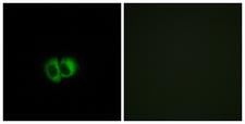OXER1 Antibody - Peptide - + Immunofluorescence analysis of MCF-7 cells, using OXER1 antibody.