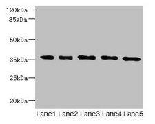 OXNAD1 Antibody - Western blot All lanes: OXNAD1 antibody at 4µg/ml Lane 1: Mouse large intestine tissue Lane 2: Mouse lung tissue Lane 3: Mouse heart tissue Lane 4: HL60 whole cell lysate Lane 5: K562 whole cell lysate Lane 6: U251 whole cell lysate Lane 7: A549 whole cell lysate Secondary Goat polyclonal to rabbit IgG at 1/10000 dilution Predicted band size: 35 kDa Observed band size: 35 kDa